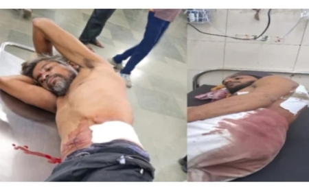 नागपुरी गेट परिसरात चाकू हल्ला, दोघे जखमी